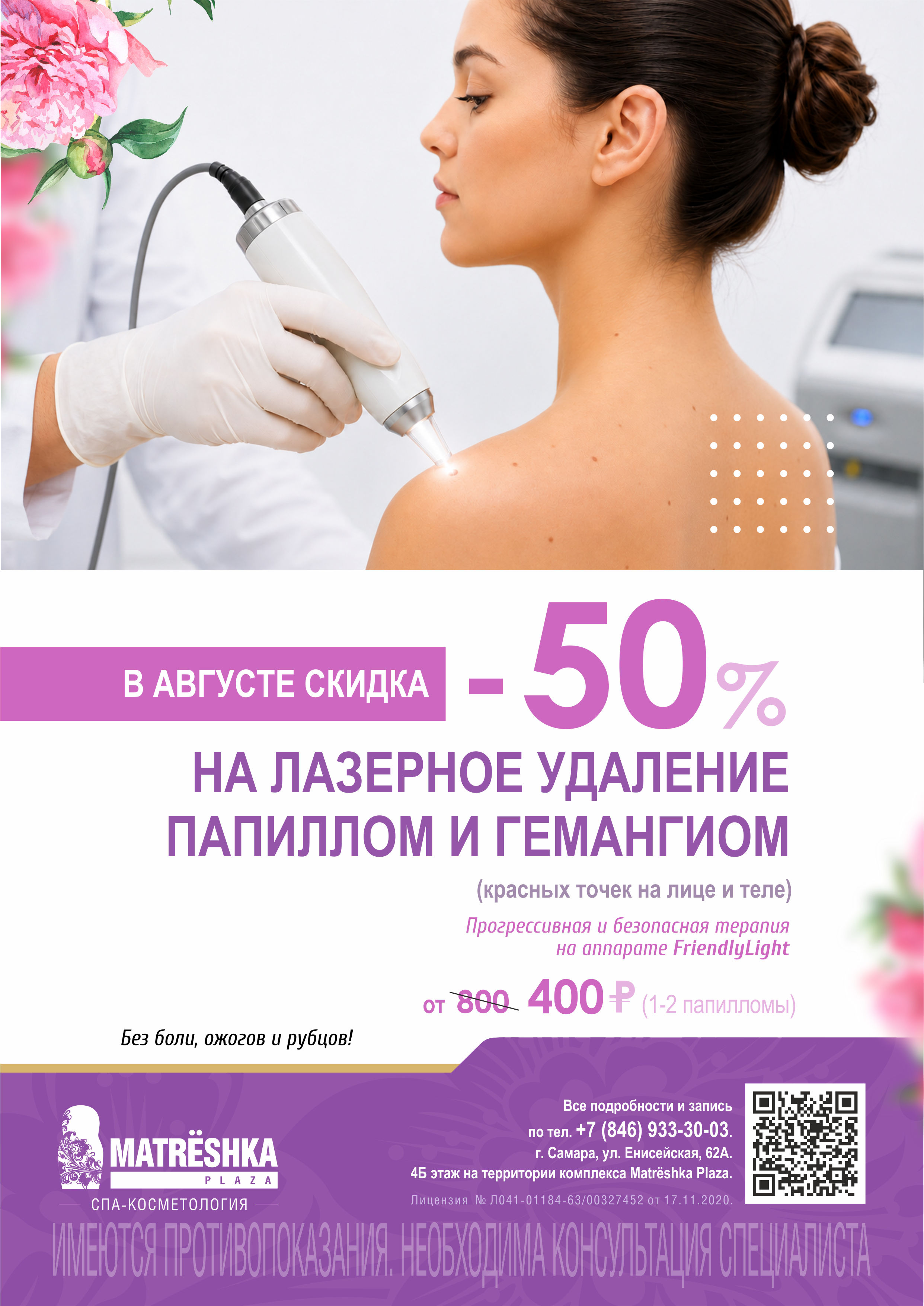 -50% на лазерное удаление папиллом и гемангиом